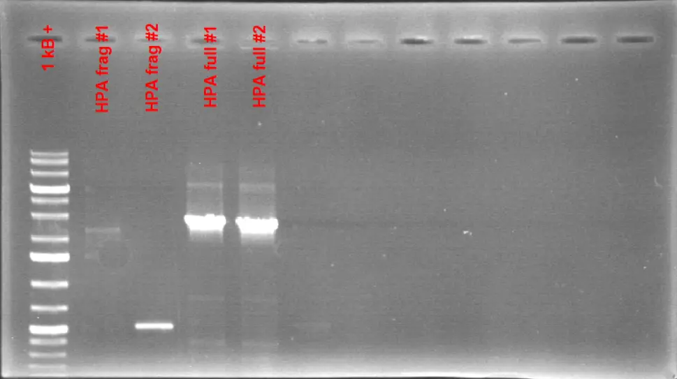 1% Agarose Gel Electrophoresis Results of the full-sized HPA fragment